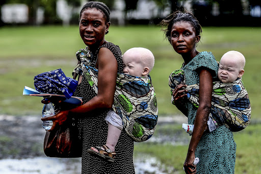 TANZANIA : Women carrying their albino children on May 5, 2014, in Dar es Salaam &#8211; pt