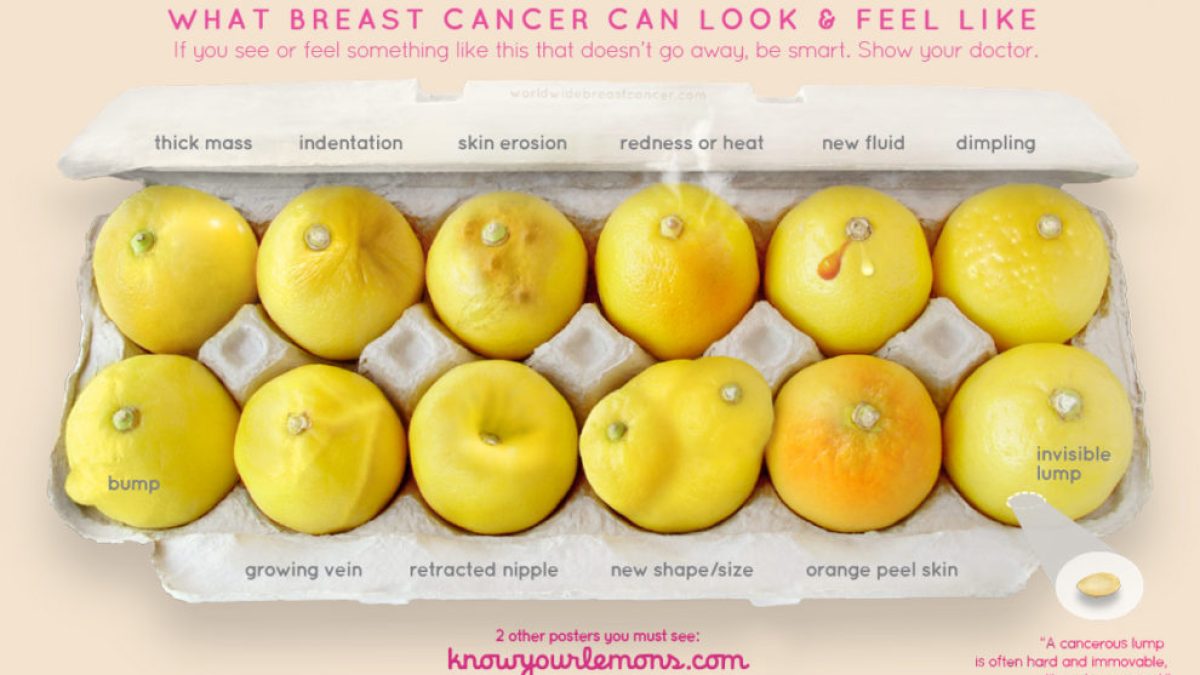 lemons2-990×622