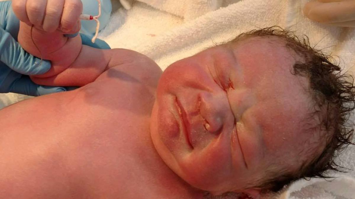 new born with IUD
