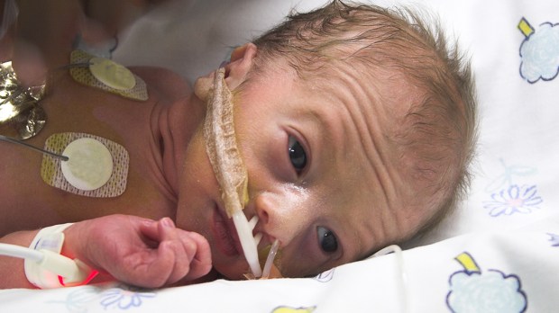 WEB3-PREMATURE-BABY-INFANT-ICU-HOSPITAL-shutterstock_3224706-Shutterstock