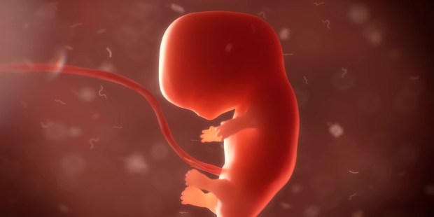 Aborto