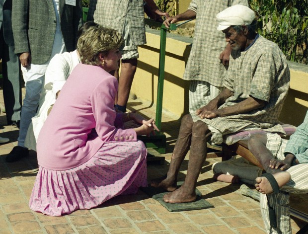 DIANA SPENCER LEPROSY