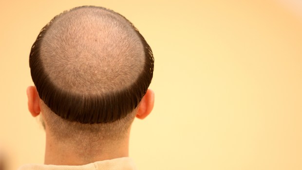 MONK HEAD