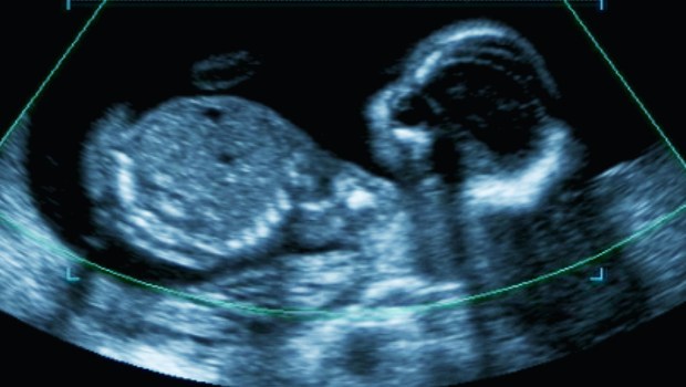 BABY ULTRASOUND