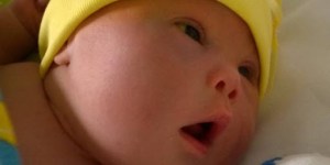 Aborto de bebês com Síndrome de Down dispara onde aborto em geral é legalizado