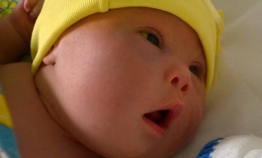 Bebê com Síndrome de Down