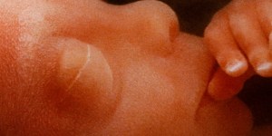 Movimento Brasil Sem Aborto pede que STF rejeite preliminarmente a descriminalização no país