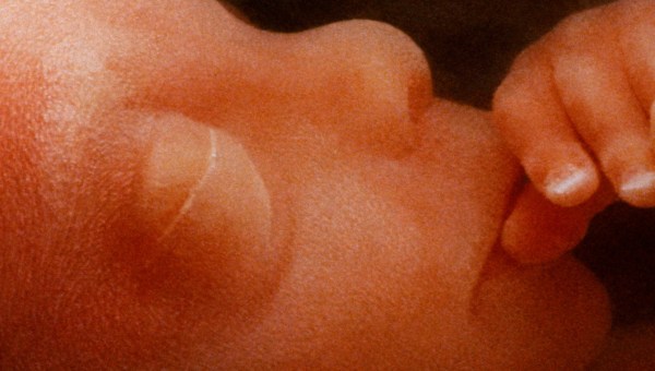 Bebê em gestação em risco de aborto