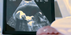 Meu bebê tem um diagnóstico pré-natal que limita a vida. E agora?
