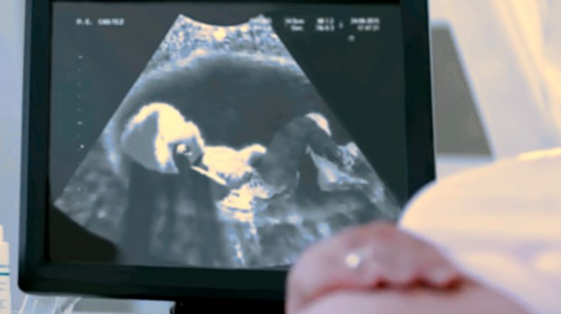 Baby shown on ultrasound with mother in foreground